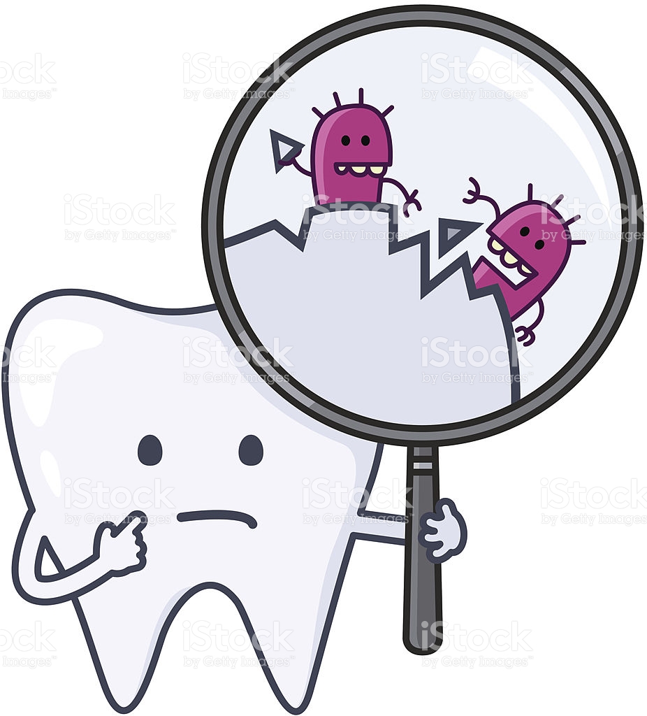 clipart tooth decay - photo #22