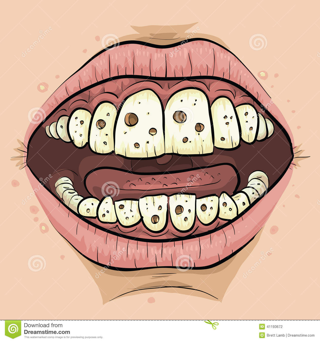 clipart tooth decay - photo #6