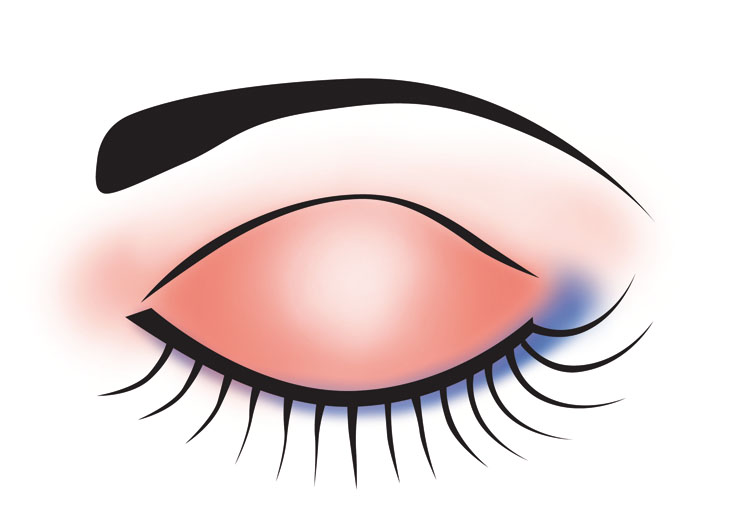 Eyelid clipart - Clipground