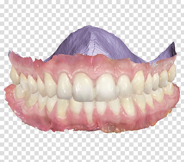 Scanner Dentistry 3Shape Patient, divider transparent.