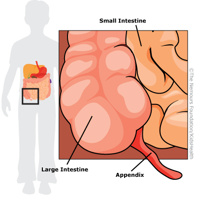 Surgeries and Procedures: Appendectomy.