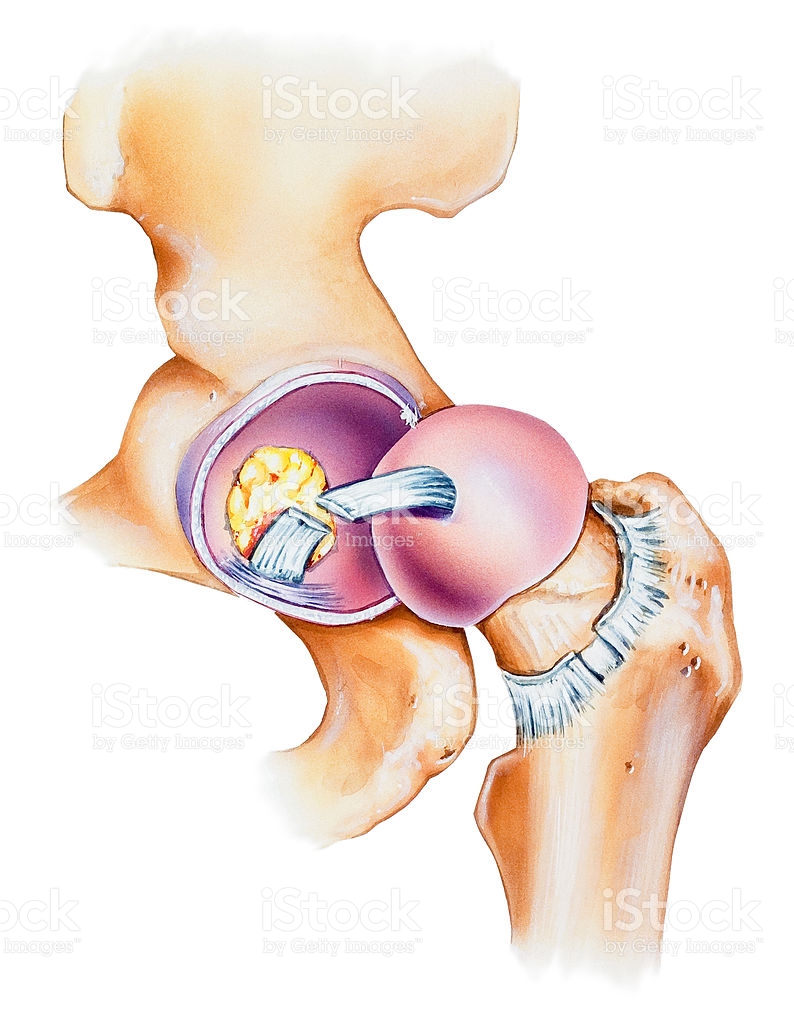 Hip Joint Opened Lateral View stock vector art 137300621.