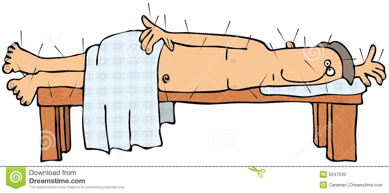 Acupuncture clipart.