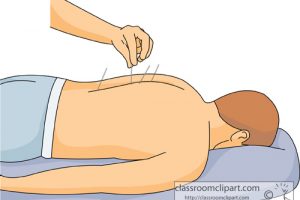 Acupuncture clipart 6 » Clipart Station.