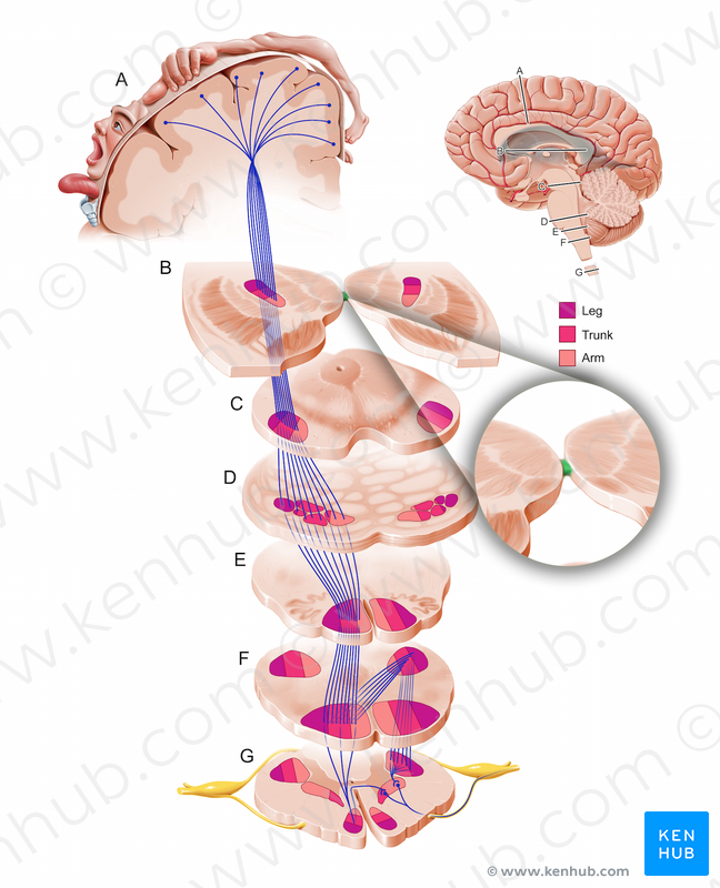 Interthalamic adhesion (Adhesio interthalamica).