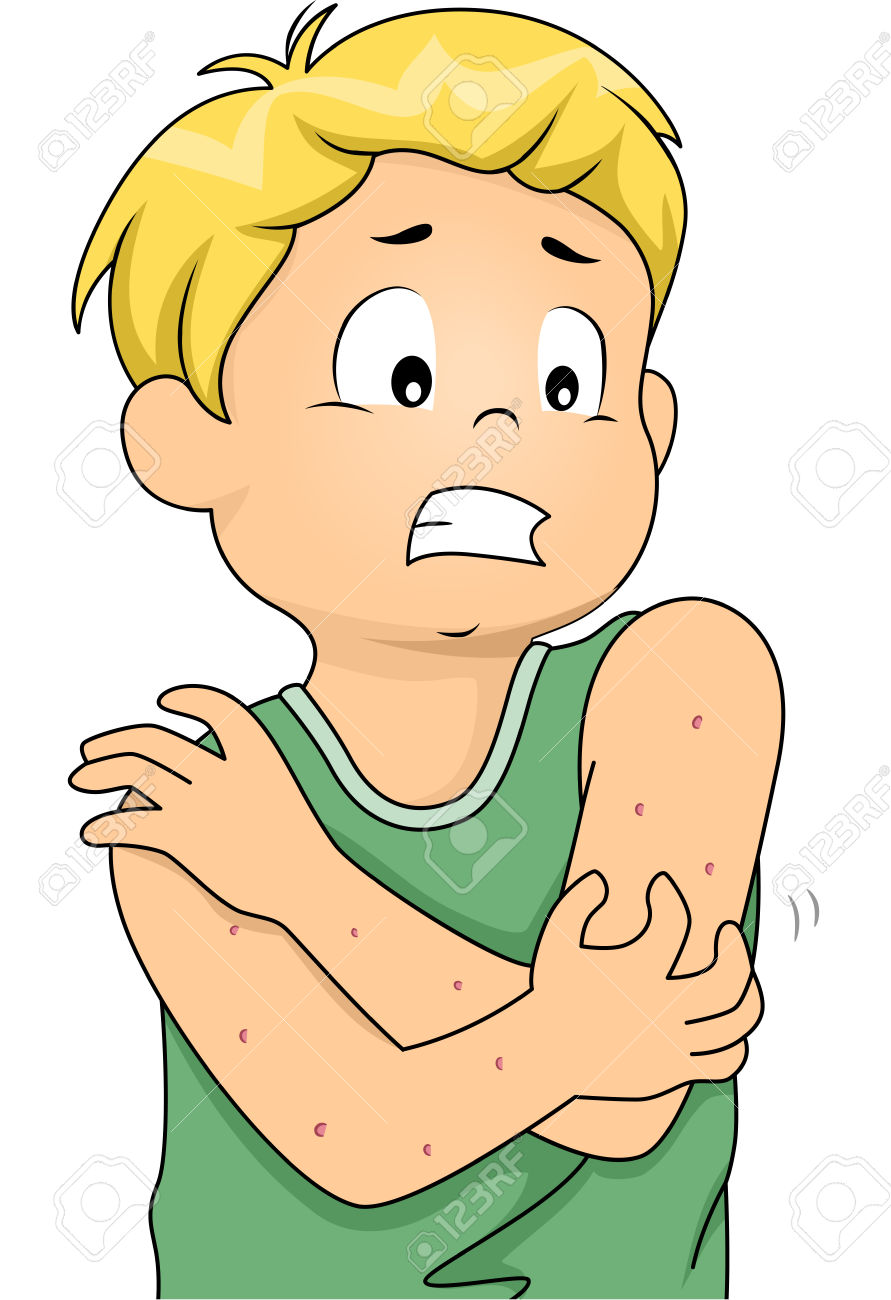Illustration Featuring A Boy Itching All Over Due To An Allergic.