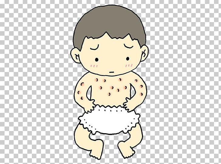 Skin Atopic Dermatitis Allergy Infant No PNG, Clipart.