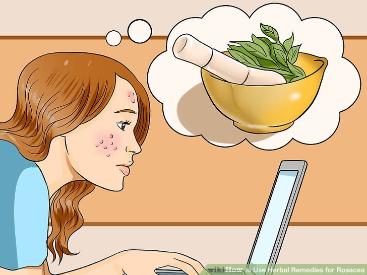 How to Use Herbal Remedies for Rosacea: 15 Steps (with Pictures).