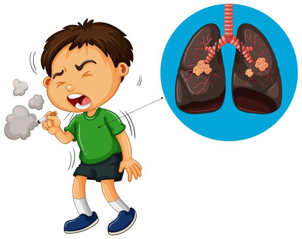 Boy smoking cigarette and unhealthy lungs diagram.