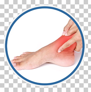 45 sprained Ankle PNG cliparts for free download.