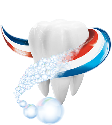 Cavities (Dental Caries).