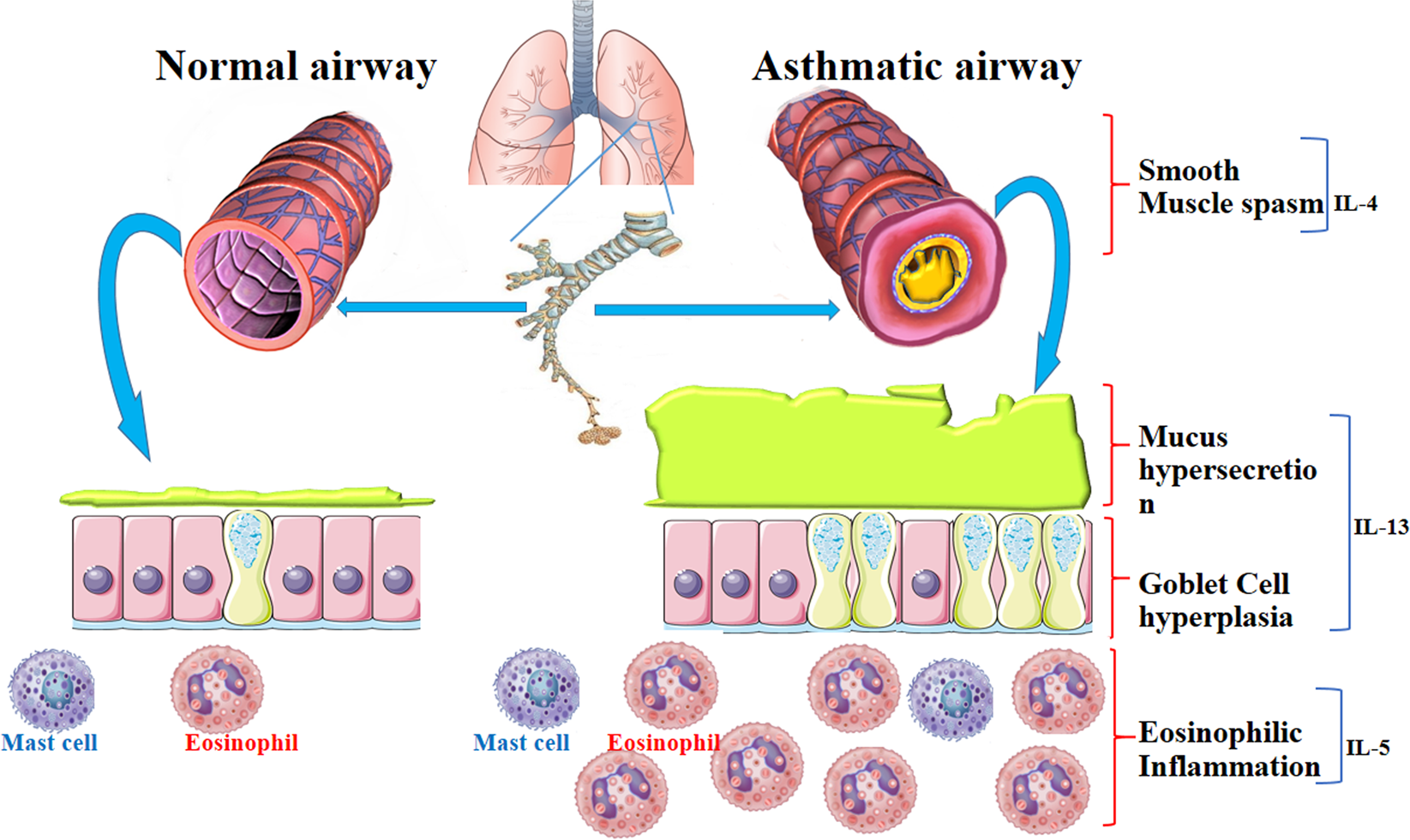 asthma-prevention-clipart-10-free-cliparts-download-images-on