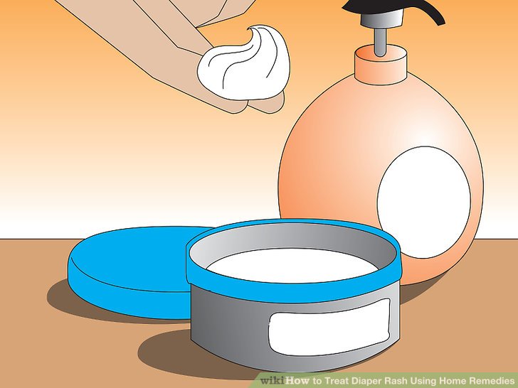 How to Treat Diaper Rash Using Home Remedies: 10 Steps.
