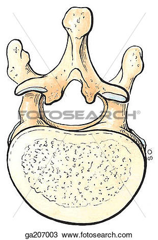 Drawing of Superior view of ossification of the ligamenta flava.
