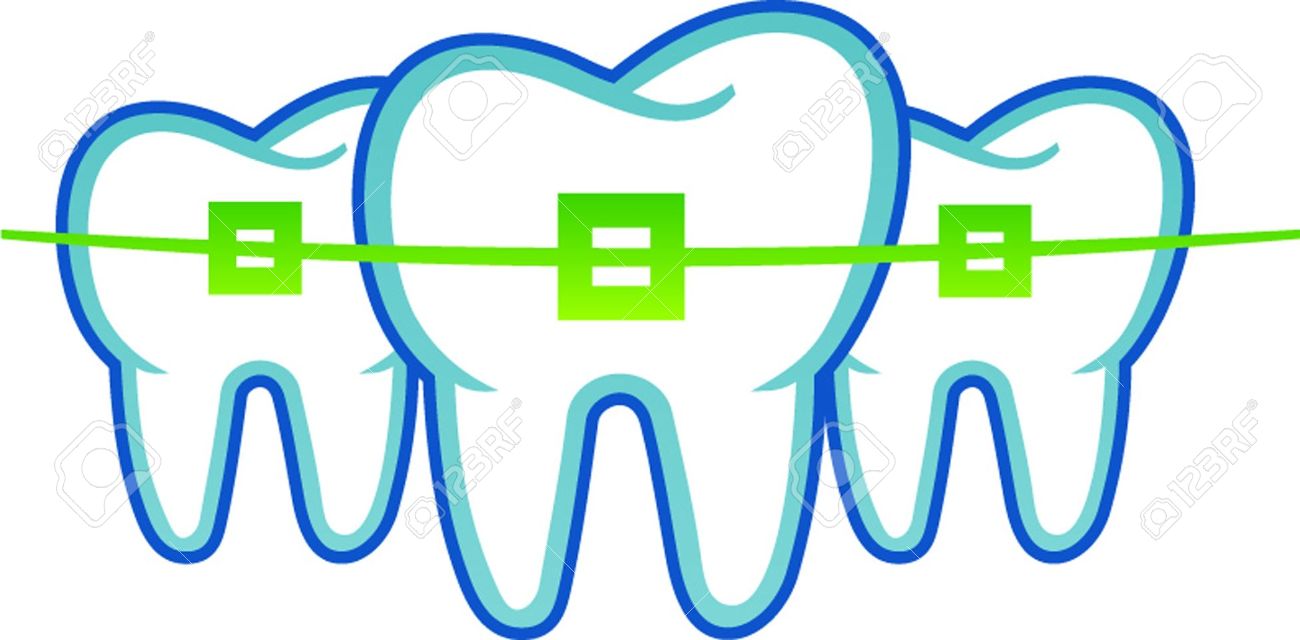 Download Braces clipart 20 free Cliparts | Download images on ...