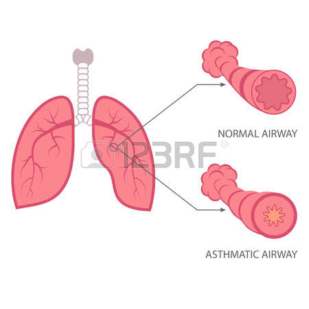 Bronchial Stock Vector Illustration And Royalty Free Bronchial Clipart.