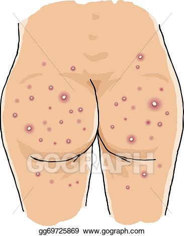 bum images clip art 20 free Cliparts | Download images on Clipground 2021