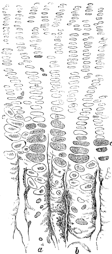 Calcification clipart.