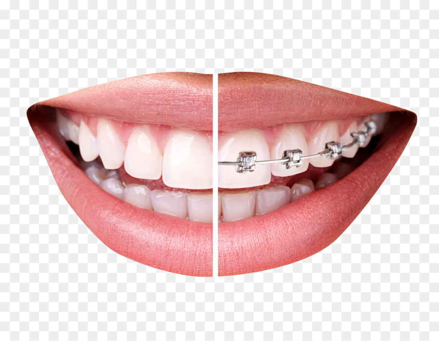 Mouth Cartoontransparent png image & clipart free download.