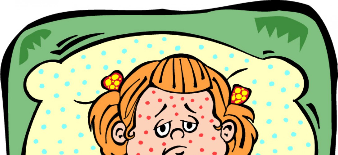 CLIPART MEASLES - 111px Image #9