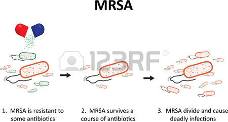 Mrsa Stock Photos Images. Royalty Free Mrsa Images And Pictures.
