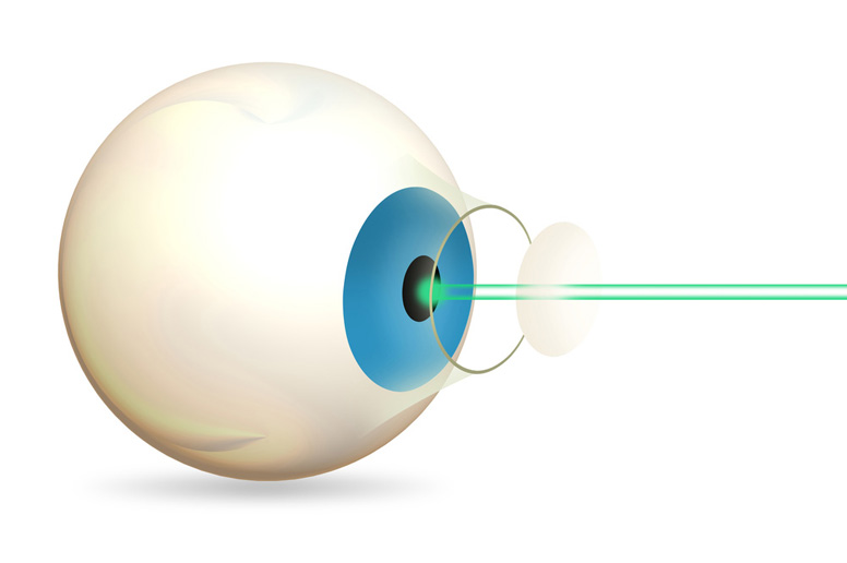 Eyes (Ophthalmology).