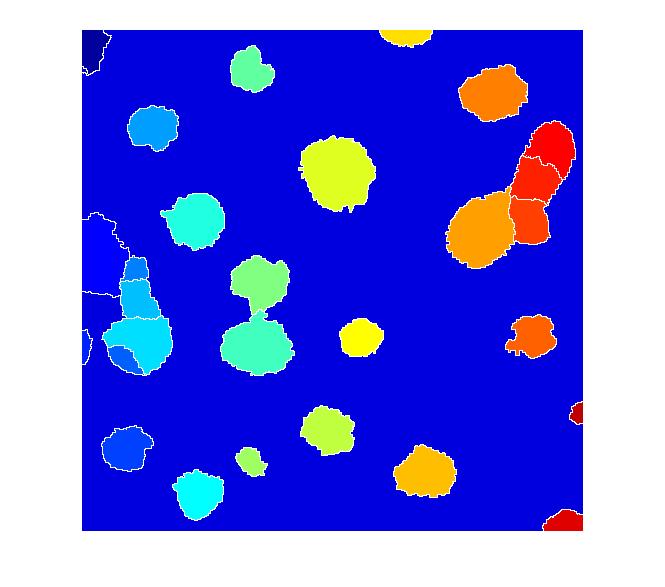Cell segmentation » Steve on Image Processing and MATLAB.