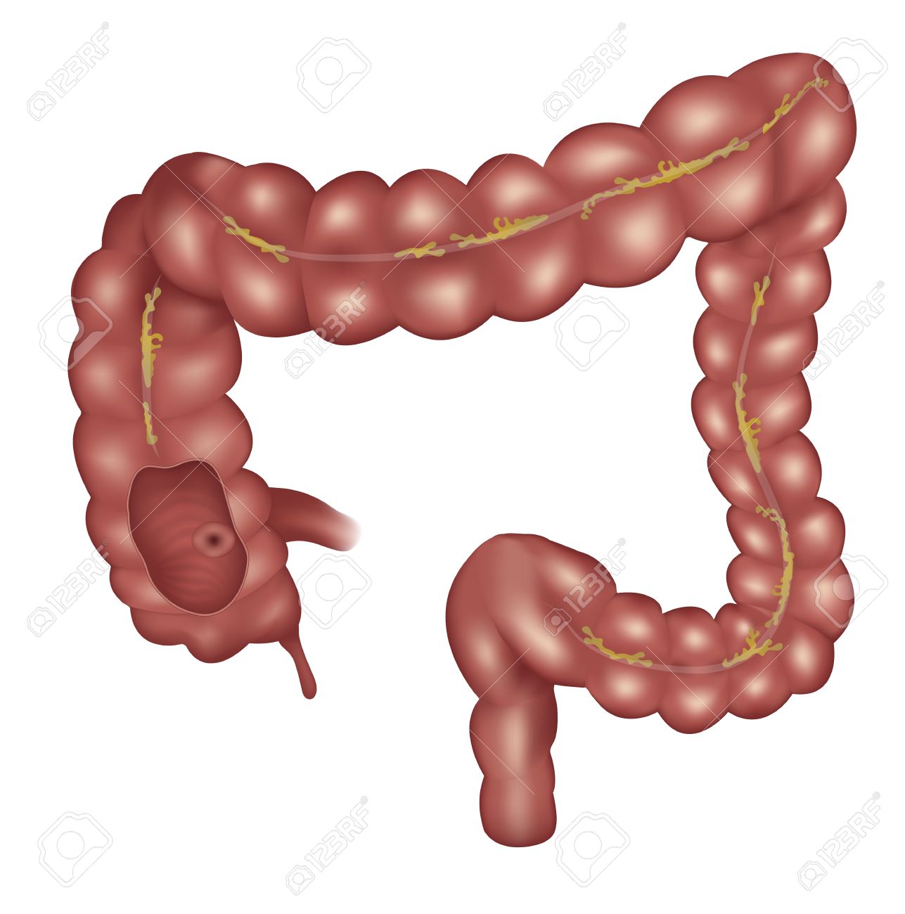 9,267 Colon Stock Illustrations, Cliparts And Royalty Free Colon Vectors.