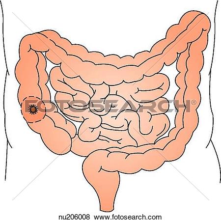 Clipart of Graphic depiction of the large intestine (colon.