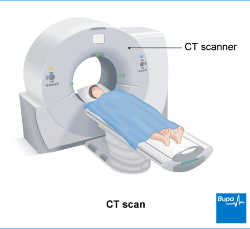 CT scan.