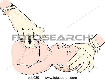 Clipart of Drawing demonstrating pressing on child's chest with.