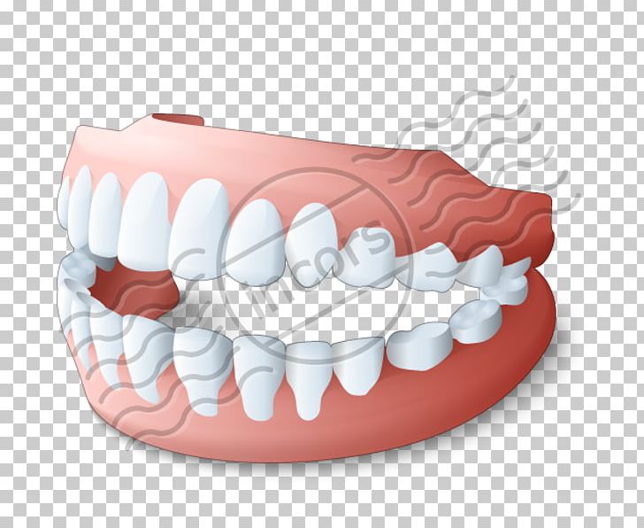 Toothbrush Dentures Dentistry Removable Partial Denture PNG, Clipart.