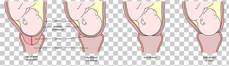 Cervical Dilation Cervical Effacement Cervix Childbirth.