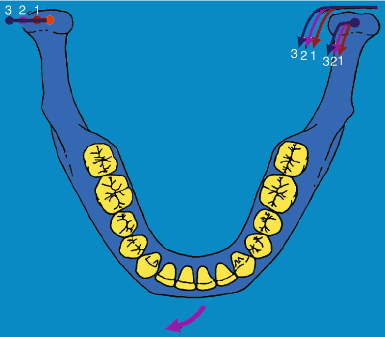 Movements and Mechanics of Mandible Occlusion Concepts and.