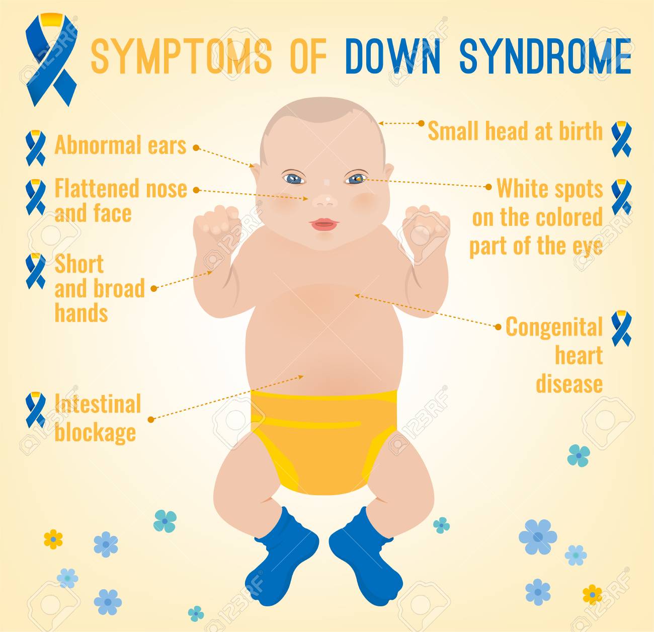 Symptoms Of Down Syndrome Poster. Vector I #364385.