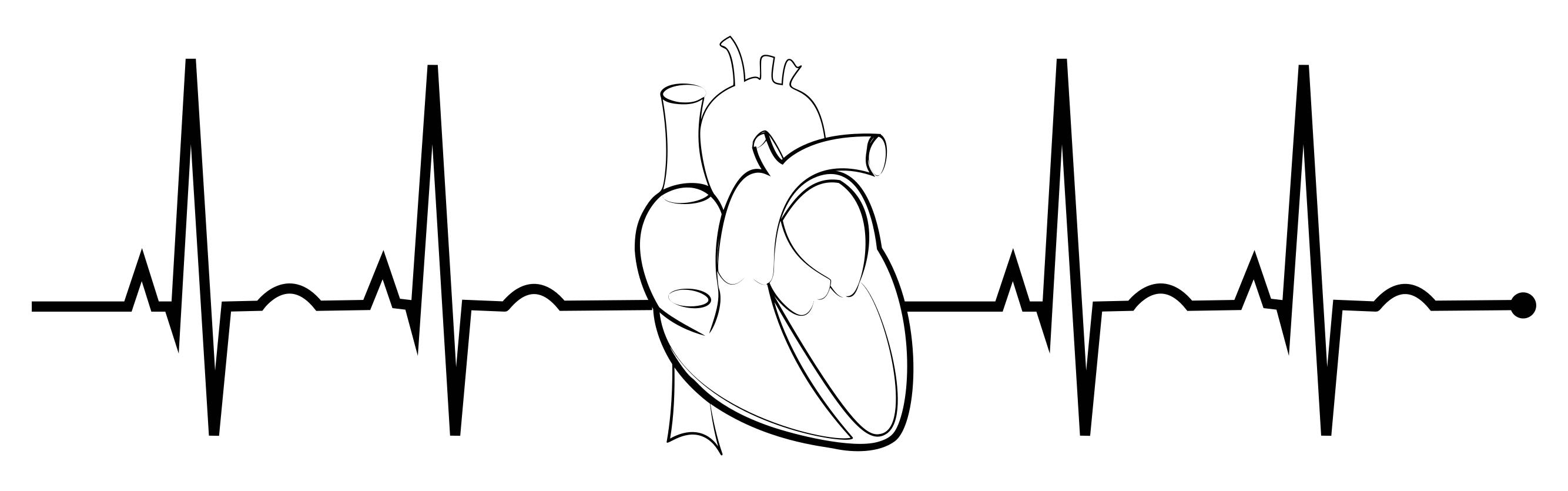 ekg clip art 20 free Cliparts Download images on Clipground 2021.