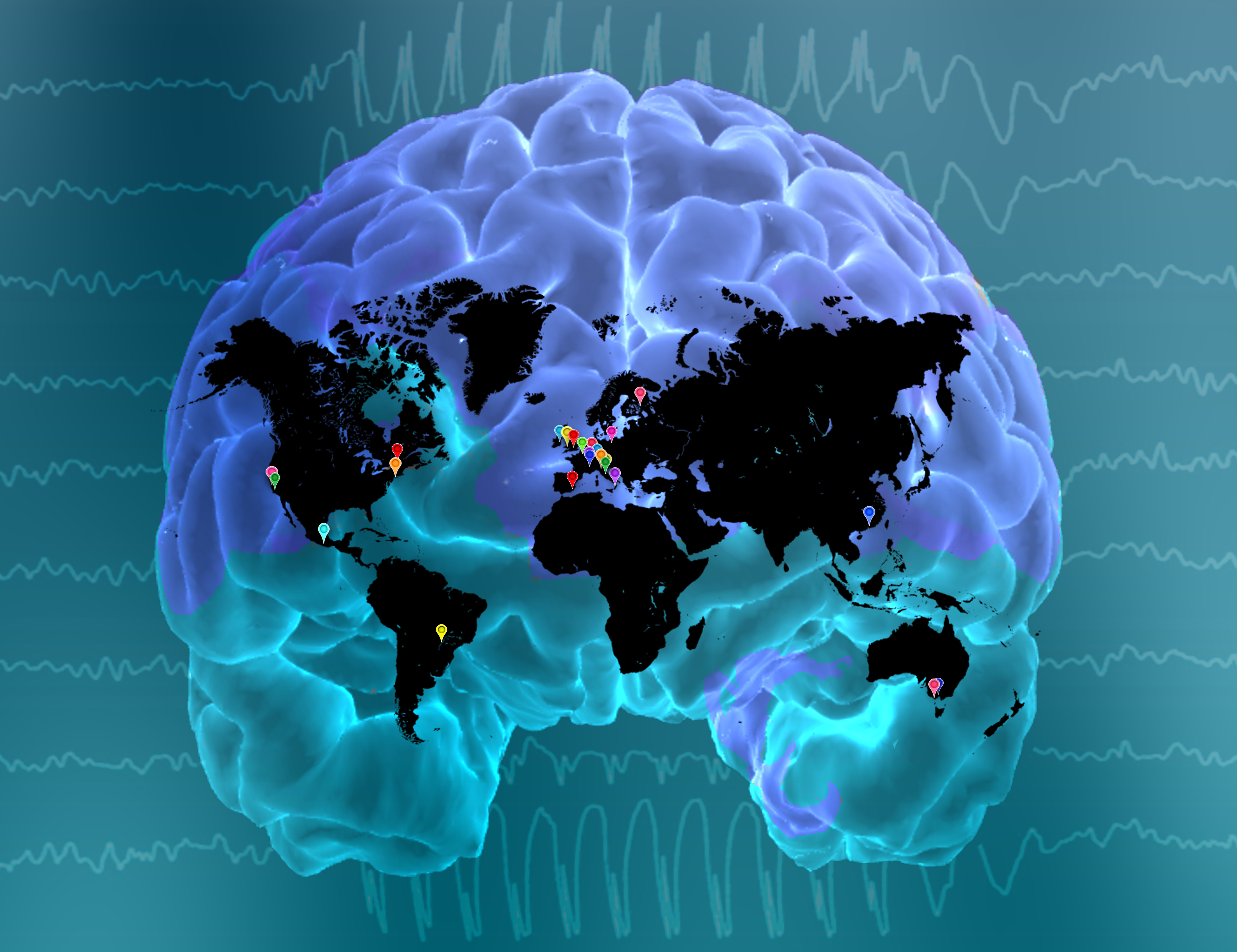 Epilepsy linked to subtle changes in brain volume and thickness.
