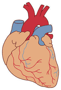 Fatty Heart Means Increased Risk of Heart Disease.