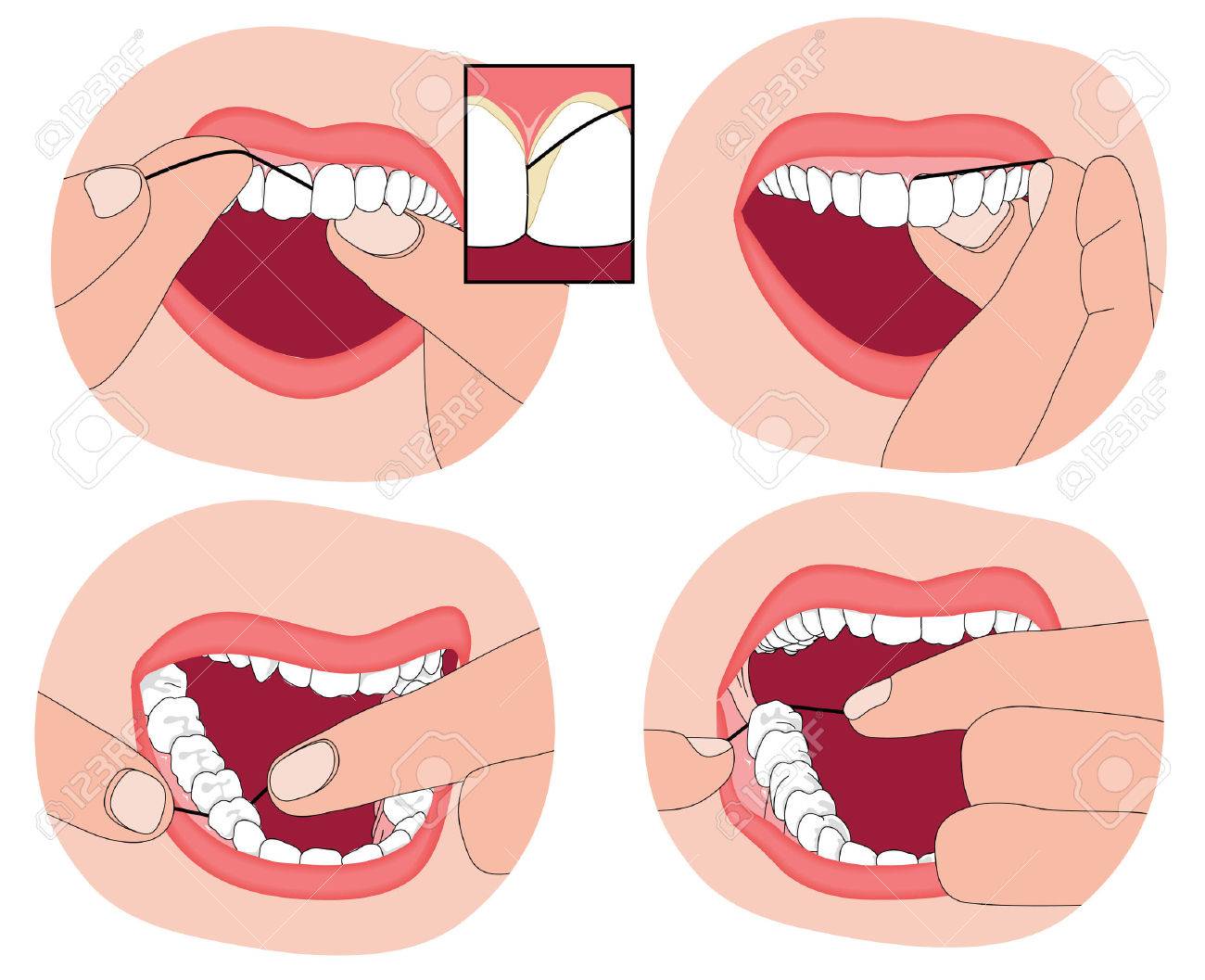 Flossing teeth, showing the floss material between the teeth...