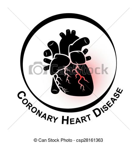 Coronary Artery Disease Clip Art.