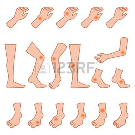 Gout clipart 20 free Cliparts | Download images on Clipground 2021