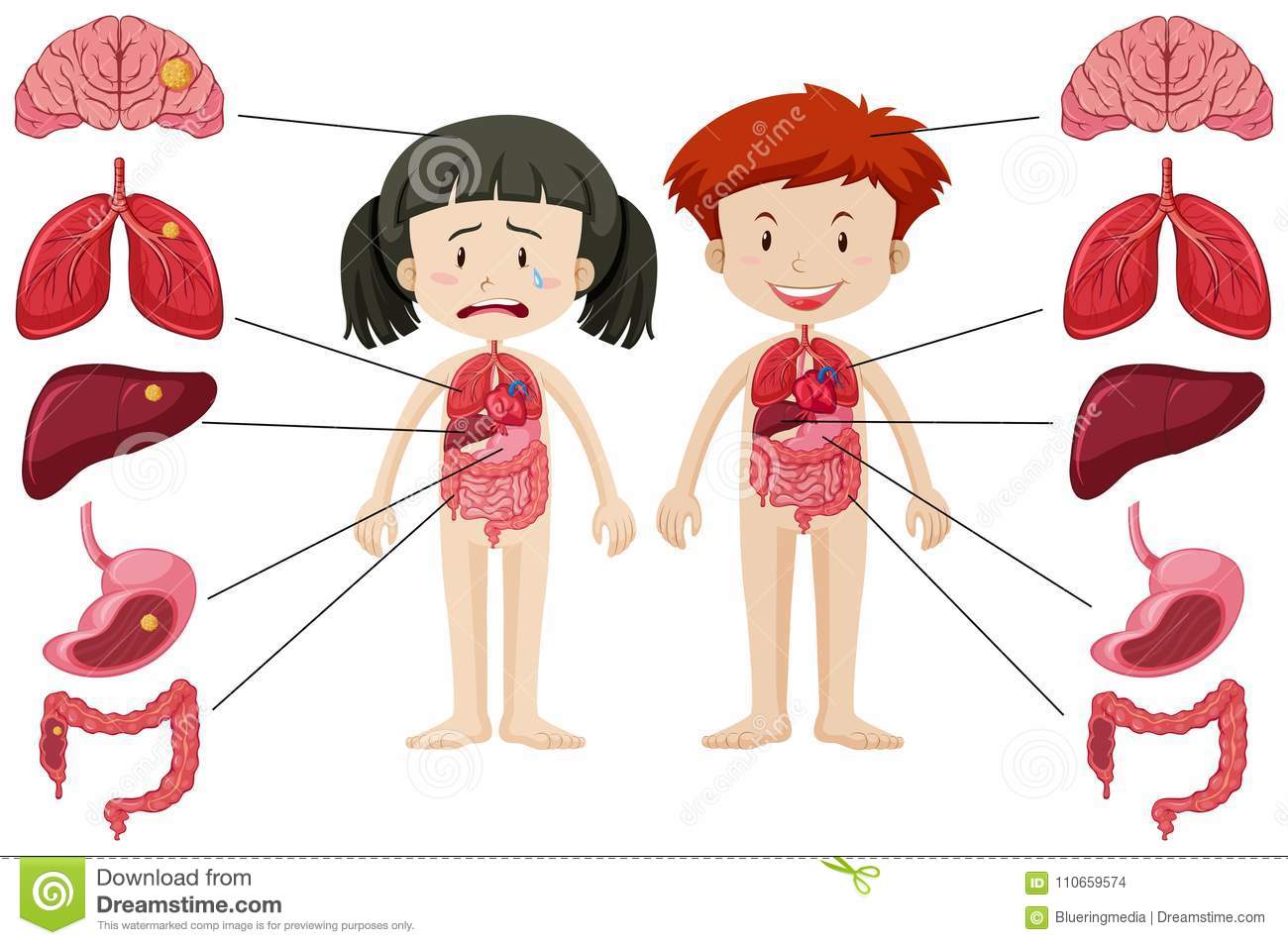 Girl And Boy With Different Healthy And Unhealthy Body Stock Vector.