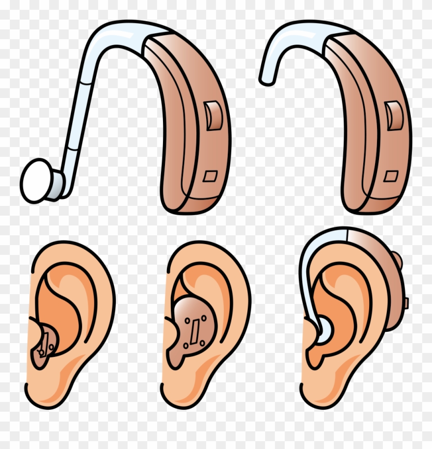 Hearing Aid Hearing Loss Clipart (#3074868).