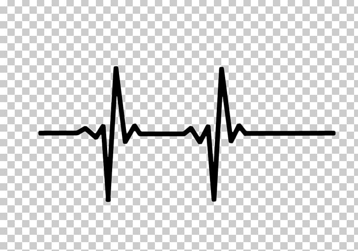 Heart Rate Monitor Pulse Electrocardiography PNG, Clipart, Ami.