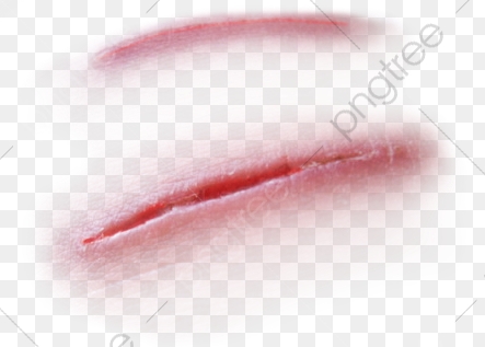 Wound Effect, Wound, Scratch, Skin Injury PNG Transparent Image and.