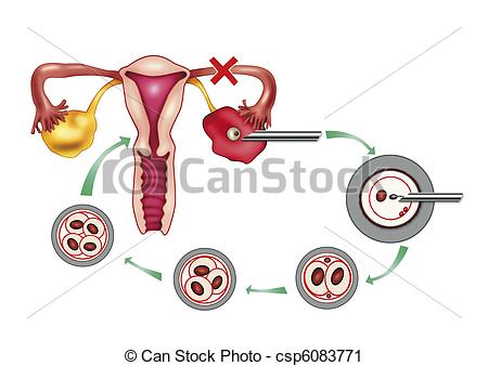 Artificial insemination Illustrations and Clip Art. 410 Artificial.