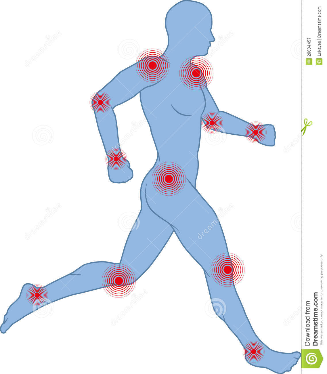 Joint Pain Clipart.