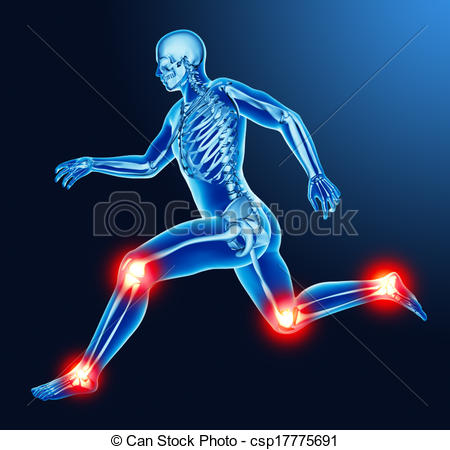 Joint pain clipart.