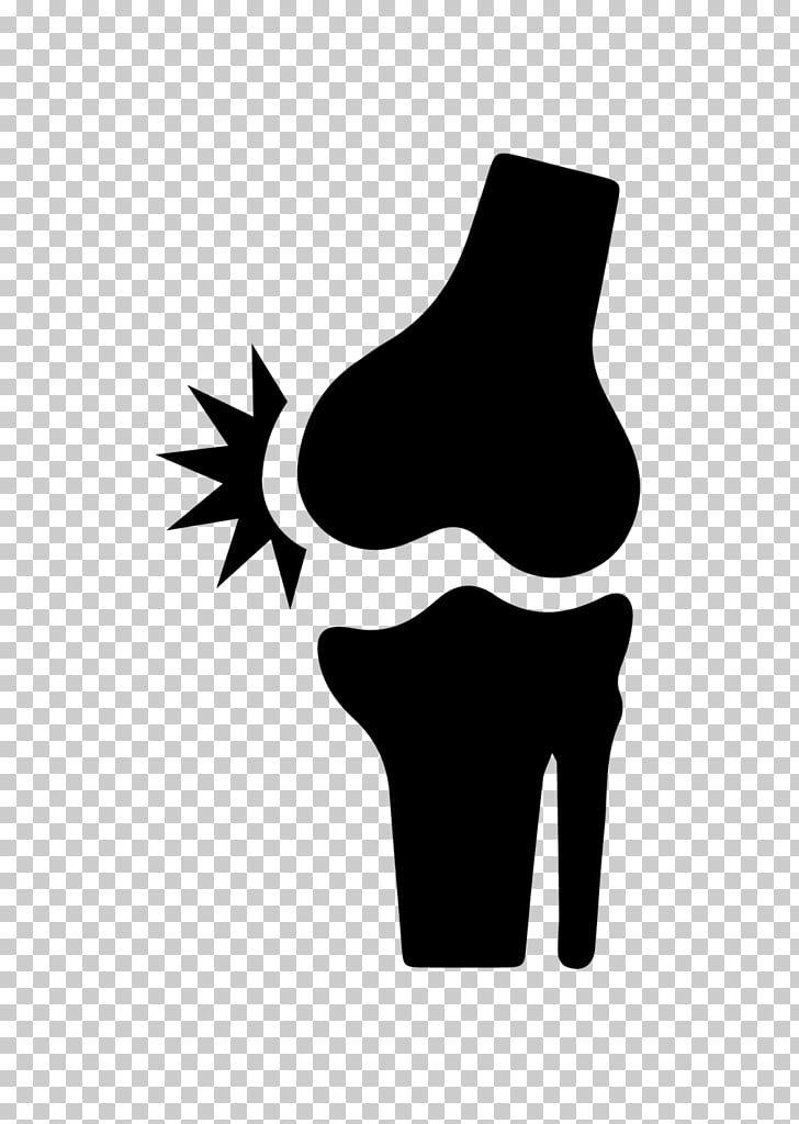 Joint pain Bone fracture Knee, Knee Pain PNG clipart.
