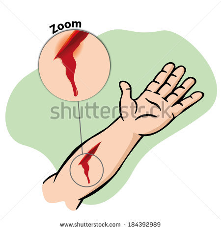 Wound Cartoon Images - Wound Clipart 4 » Clipart Station ...